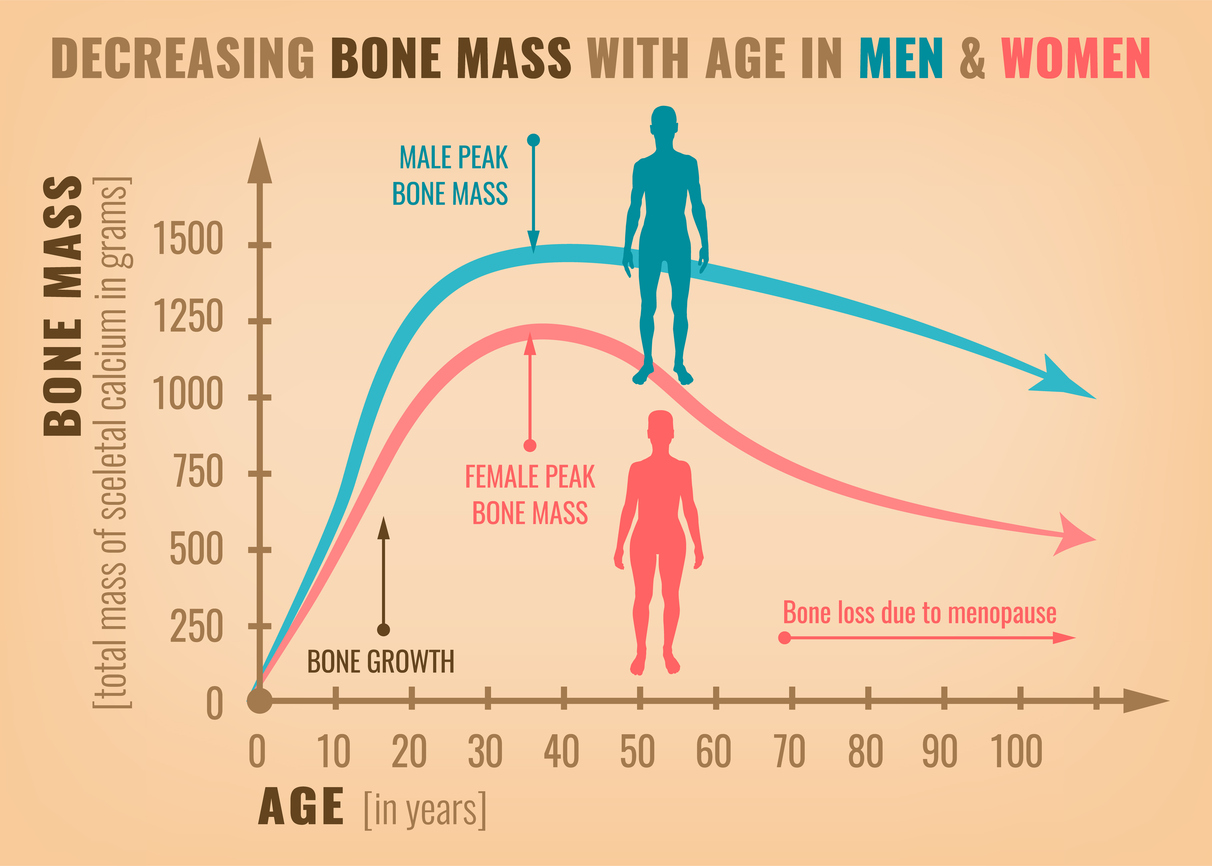 Risks of Decreasing Bone Mass