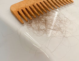 Photo of hair in a comb