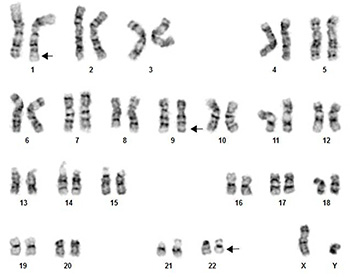 Chromosome analysis