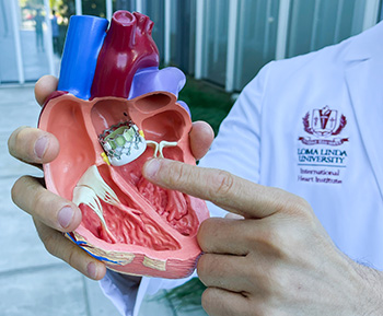 Amr Mohsen points to a TAVR in a three dimensional replica of a human heart