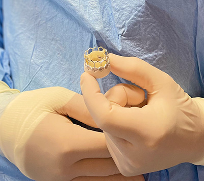 TAVR valve