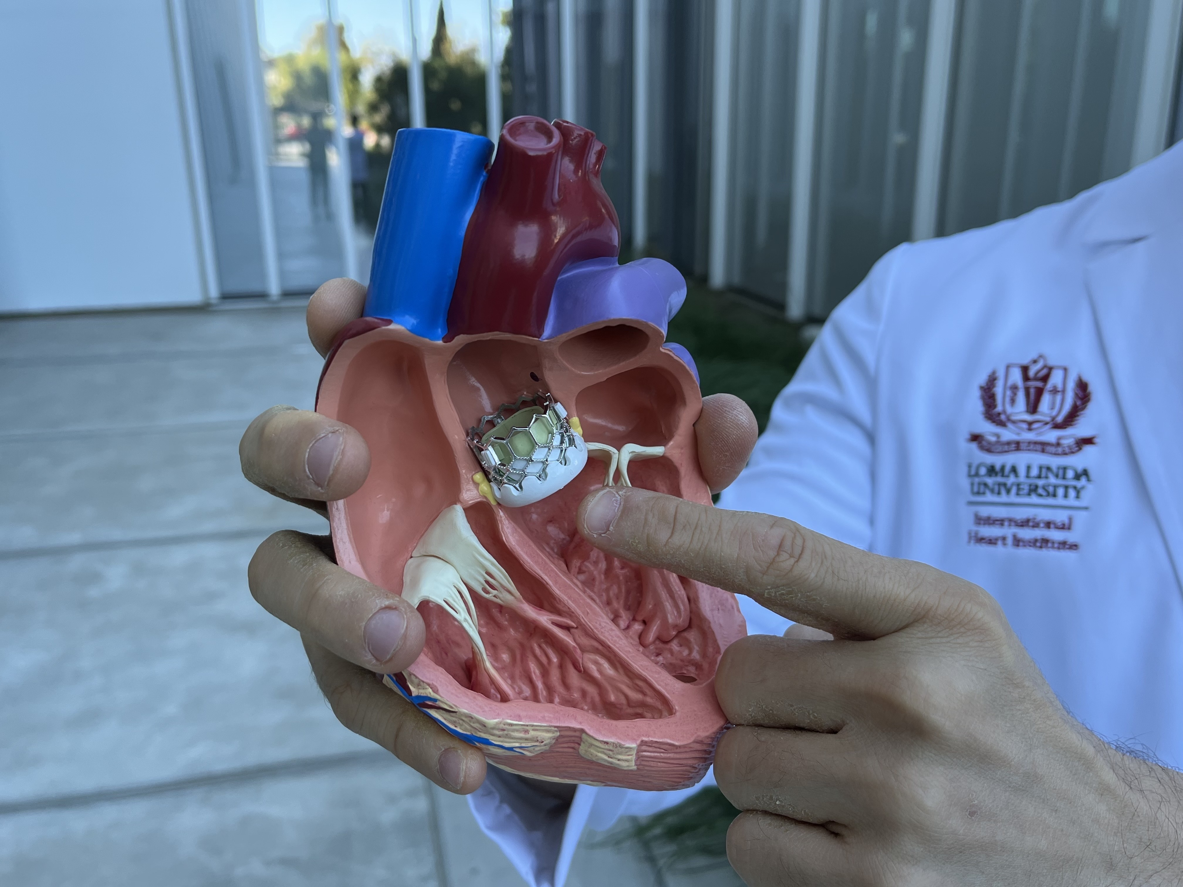 a 3d model of a heart is open to show a device inserted in it