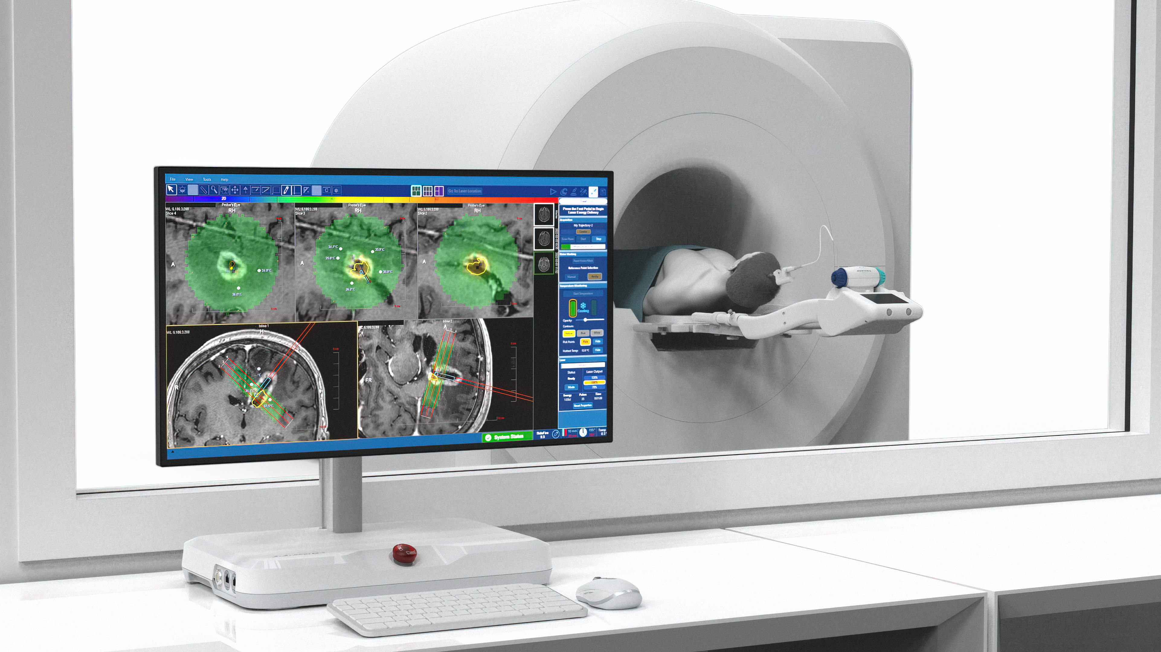 Graphic of an MRI showing a brain scan during a procedure