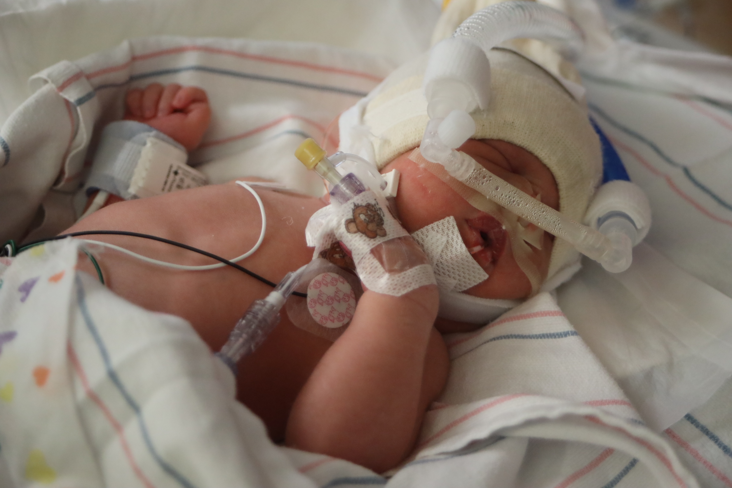 baby with medical monitors hooked up