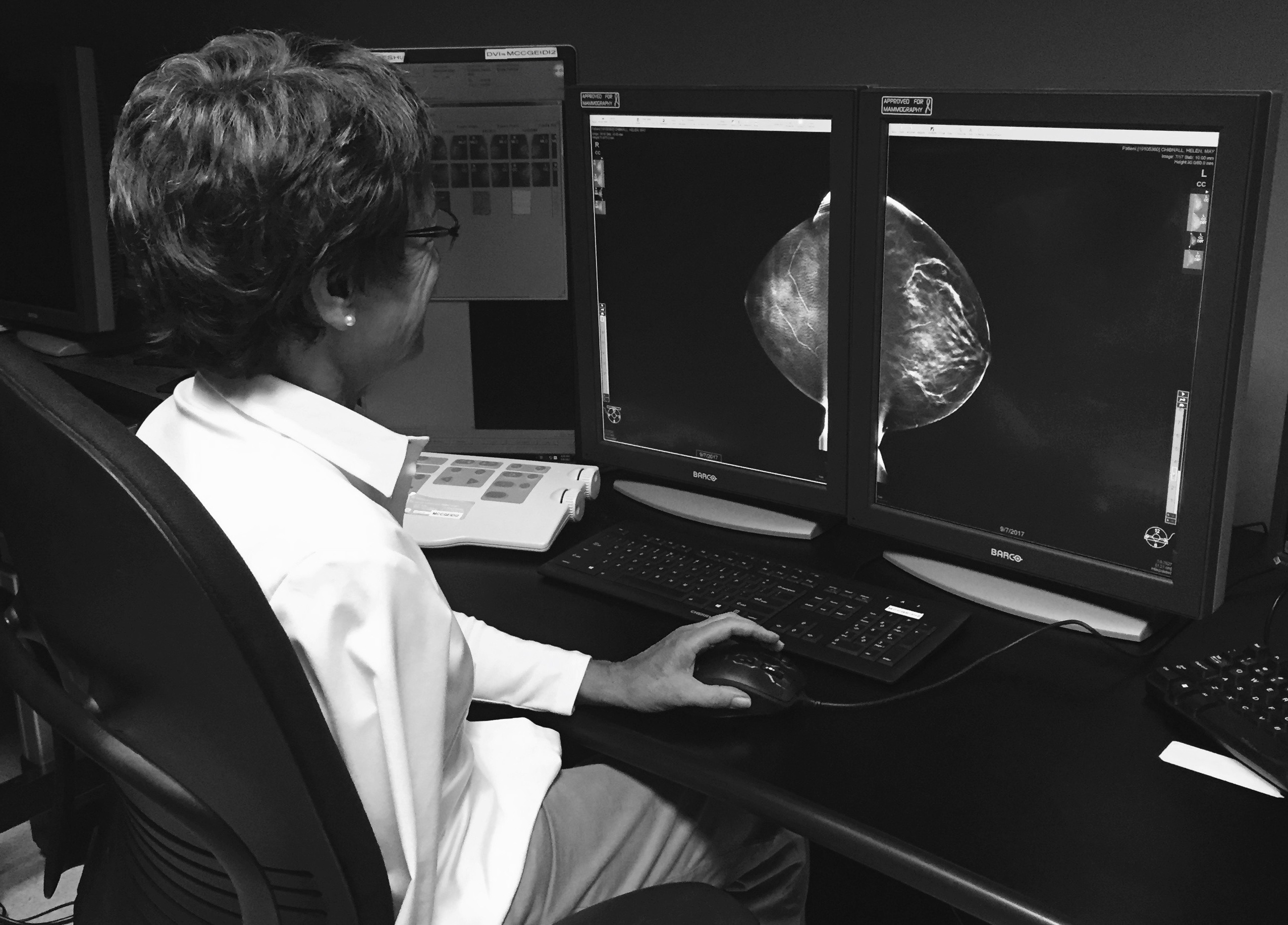 Black and white photo of a woman sitting at a computer looking at a medical image.