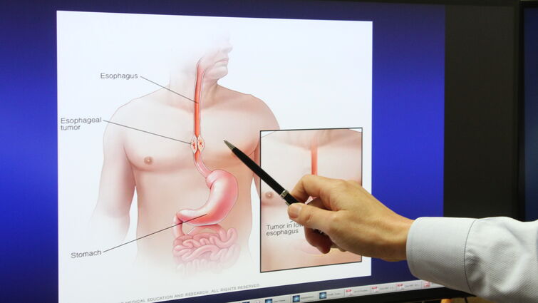 a model of a human body is shown on a screen and a pen is used to point to the esophagus.