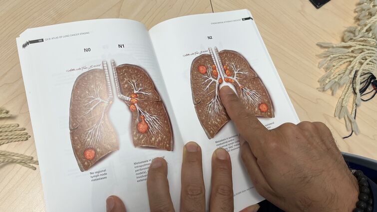 a man points to a picture of lung