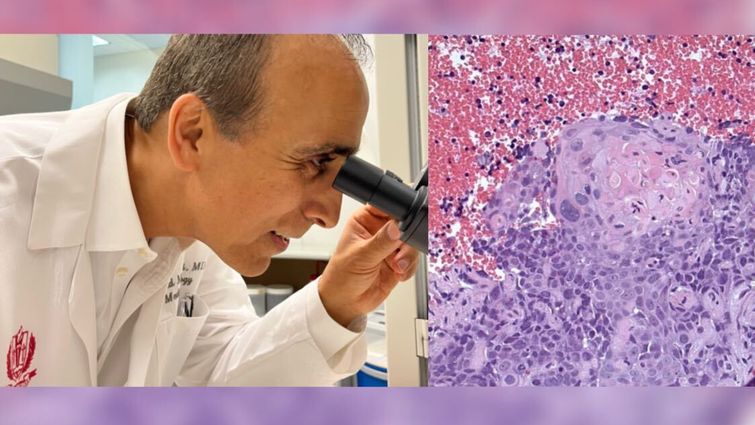 On the left, lung cancer expert Hamid Mirshahidi, MD, peers into a microscope; on the right is an image of what a type of lung cancer looks like on the microscopic level.