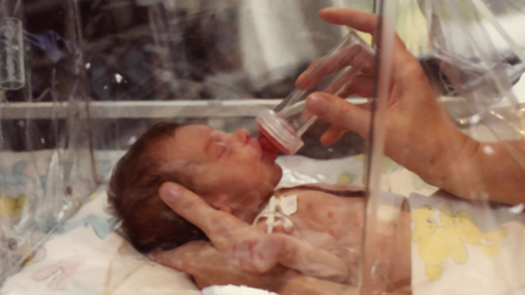 Brave girl was born with heart outside chest (Video)