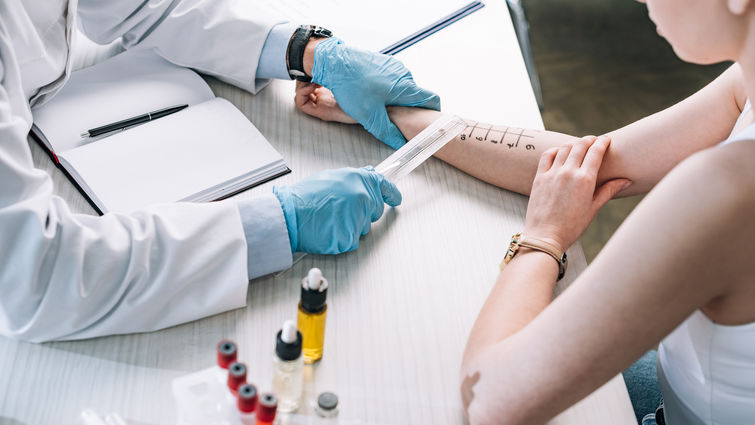 overhead view of allergist holding ruler near marked hand of woman