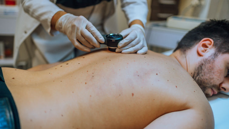 Dermatologist inspecting patient skin moles - stock photo