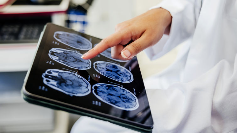 Close-up Shot of a Doctor's Hand Pointing on Brain Scan Images on Digital Tablet