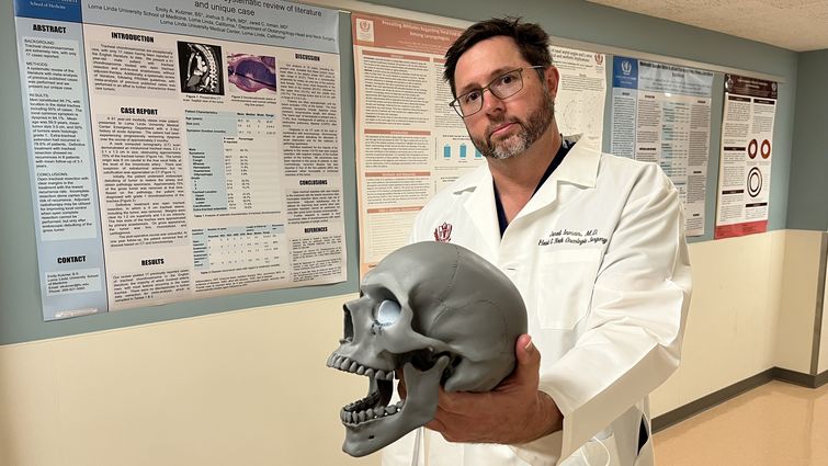 Jared Inman, MD, a head and neck surgical oncologist at Loma Linda University Health, holds a 3D replica of a human skull, around which various cancers can form.