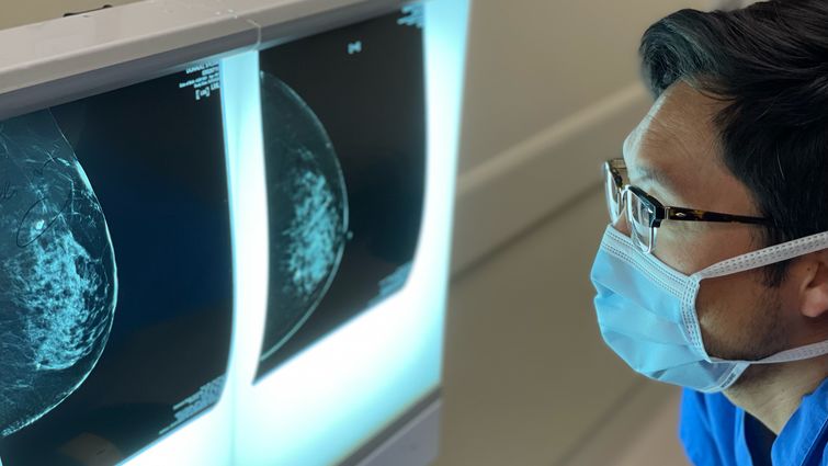 Jukes Namm, MD, assesses a patient's scan results and is familiar with the 'scanxiety,' many patients feel throughout this process. Namm discusses the common survivorship challenge and offers tips to help manage the distress. Jukes Namm, MD, looks at a scan