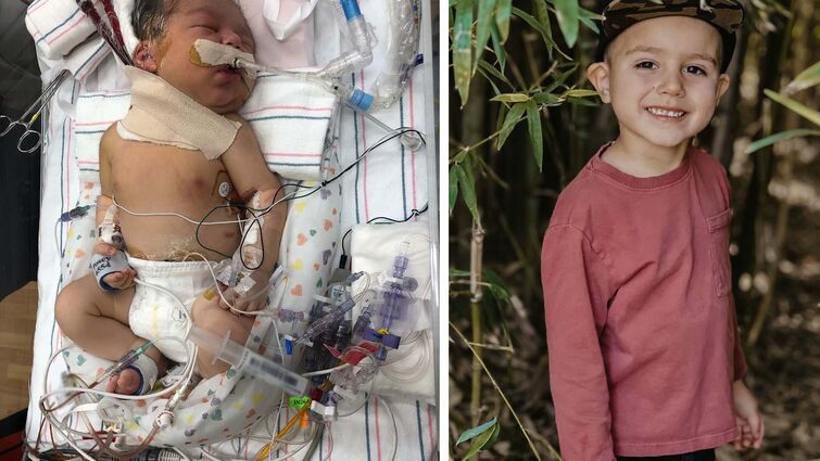 patient in the NICU and present day