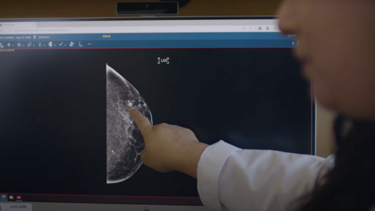 Hand pointing at breast scan