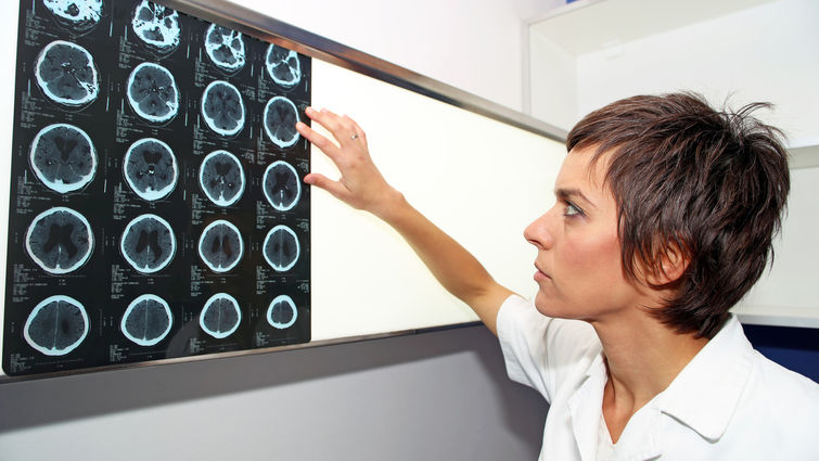 Woman doctor looking at brain scans
