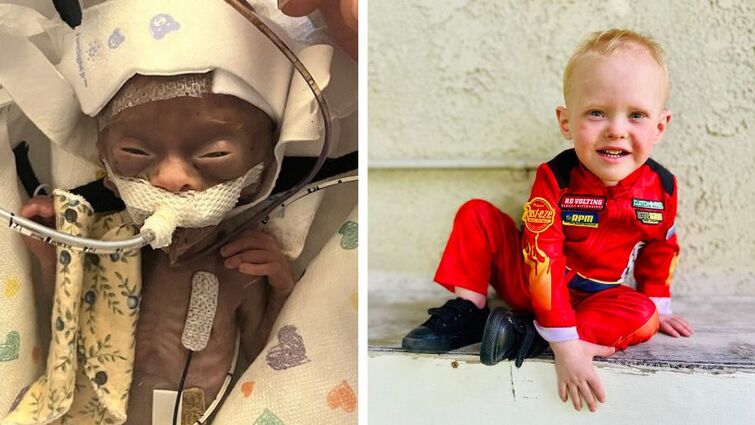 Side-by-side photo of Noah when he was just born and now