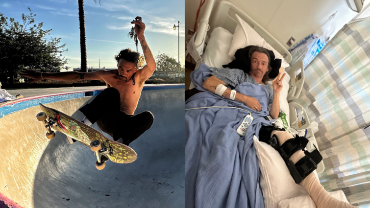 One the left side, a skateboarder is in a skate bowl shirtless, on the right side, the same skateboarder lays in a hospital bed with a cast on his leg holding up the peace sign