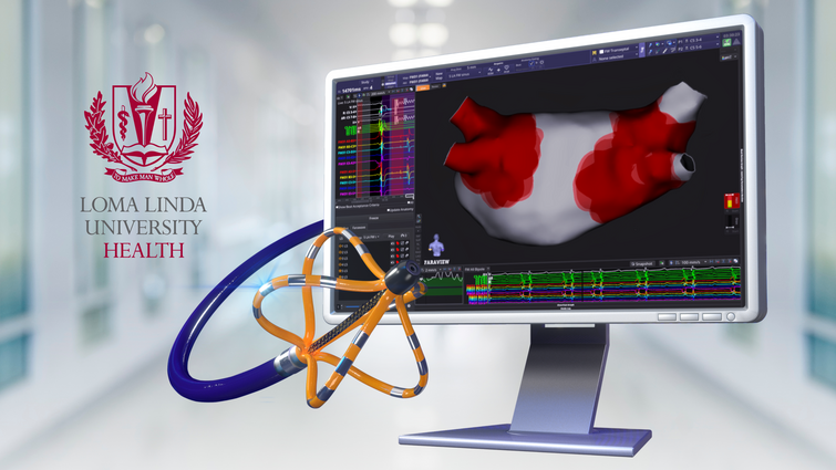Ultra-high-definition cardiac mapping displayed the medical system, showing real-time catheter positioning during an atrial fibrillation ablation procedure.