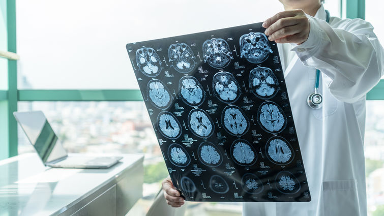 Doctor holding brain scan stock photo