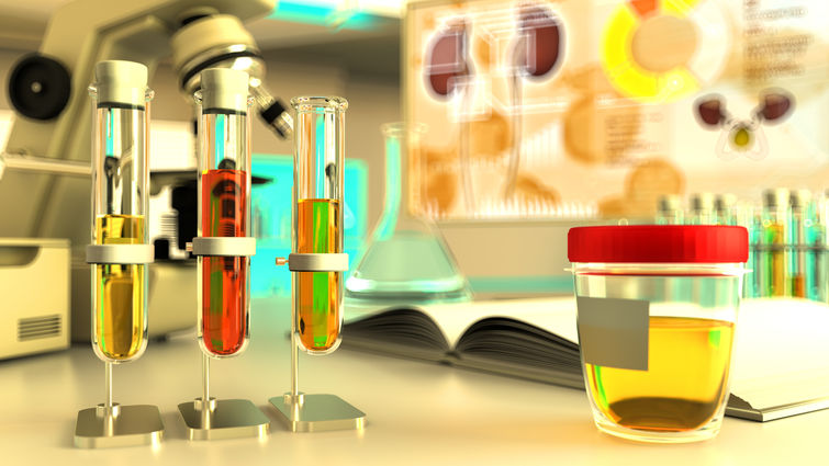 Urine samples in a lab