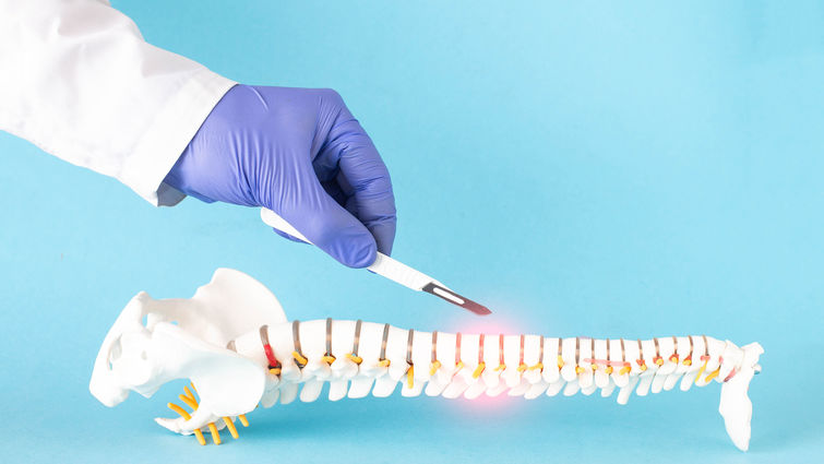 Spine surgery Spine surgery