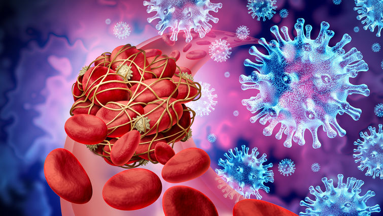 Illustration of COVID-19 viral particles floating next to a blood clot