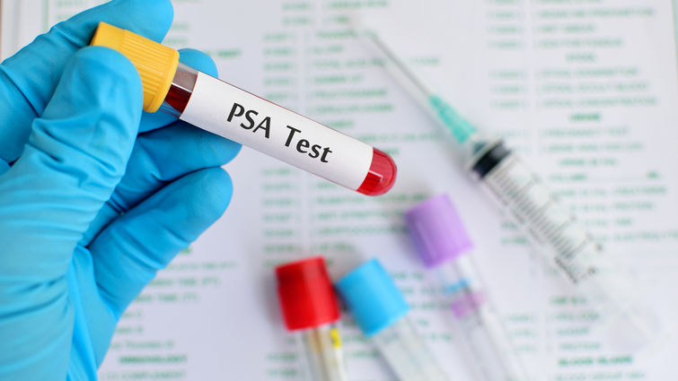 Gloved hand holding a vile of blood labeled "PSA Test"