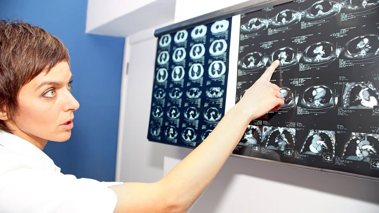 Lung Scan Lung Scan