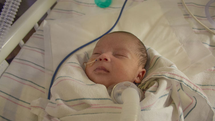 Jethro Quach at three weeks old in the NICU at LLU Children's Hospital Jethro Quach at three weeks old in the NICU at LLU Children's Hospital