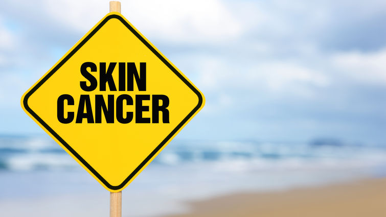 Skin cancer sign on the beach