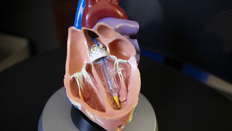 Graphic of heart model