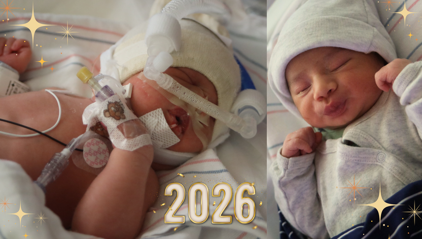 a newborn with medical equipment attached to their body is next to another newborn holding their arms up