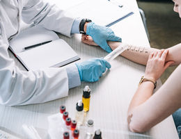 overhead view of allergist holding ruler near marked hand of woman