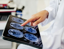 Close-up Shot of a Doctor's Hand Pointing on Brain Scan Images on Digital Tablet