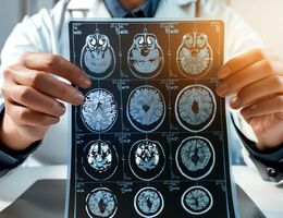MRI Brain Scan. Doctor shows MRI Brain Scan of head and skull.