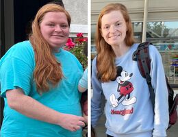 Breaking the cycle: A mother’s journey through weight loss surgery