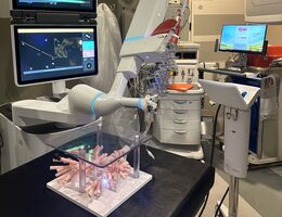 The large, white ION Robotic arm is positioned over a replica of the lungs on a black table