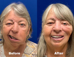 Woman gets her smile back after losing it for four years