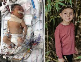patient in the NICU and present day