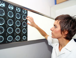 Do strokes affect women differently?