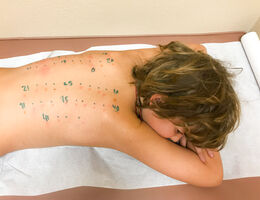 Child lays in a doctor's office while getting tested for allergies on his back.