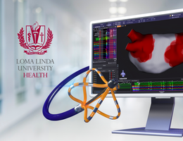 Ultra-high-definition cardiac mapping displayed the medical system, showing real-time catheter positioning during an atrial fibrillation ablation procedure.