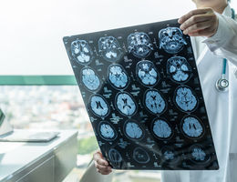 Doctor holding brain scan stock photo