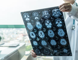 Doctor holding brain scan stock photo