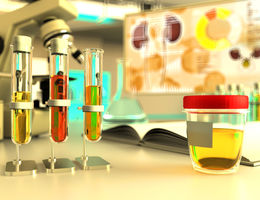 Urine samples in a lab