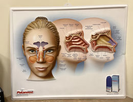 Diagram of human sinuses and nasal ducts