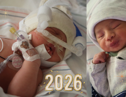 a newborn with medical equipment attached to their body is next to another newborn holding their arms up
