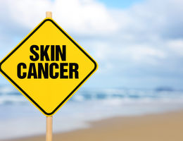 Skin cancer sign on the beach